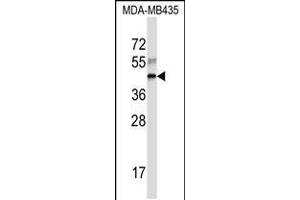 Western blot analysis in MDA-MB435 cell line lysates (35ug/lane). (RPL3 抗体  (AA 224-251))