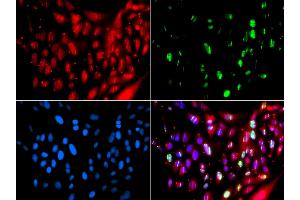 Immunofluorescence analysis of GFP-RNF168 transgenic U2OS cells using UIMC1 antibody. (UIMC1 抗体)