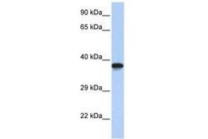 Image no. 1 for anti-DMRT-Like Family C2 (DMRTC2) (AA 72-121) antibody (ABIN6740463) (DMRTC2 抗体  (AA 72-121))