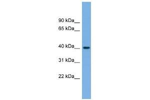 BVES antibody used at 1 ug/ml to detect target protein.