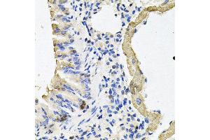 Immunohistochemistry of paraffin-embedded mouse lung using MYH7 antibody at dilution of 1:100 (x40 lens). (MYH7 抗体)