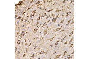 Immunohistochemistry (Paraffin-embedded Sections) (IHC (p)) image for anti-Ribosomal Protein S14 (RPS14) (AA 1-151) antibody (ABIN6147198)