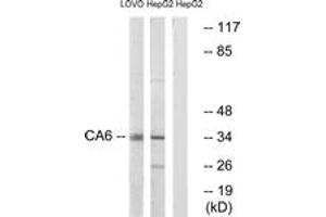 Western blot analysis of extracts from HepG2/LOVO cells, using CA6 Antibody. (CA6 抗体  (AA 231-280))