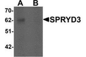 Western blot analysis of SPRYD3 in human brain tissue lysate with SPRYD3 antibody at 1 μg/ml in (A) the absence and (B) the presence of blocking peptide. (SPRYD3 抗体  (Center))