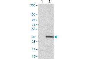 Western blot analysis of Lane 1: Negative control (vector only transfected HEK293T lysate). (ADO 抗体)