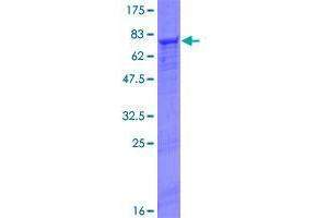 Image no. 1 for Fibrinogen-Like 2 (FGL2) (AA 1-439) protein (GST tag) (ABIN1354060)