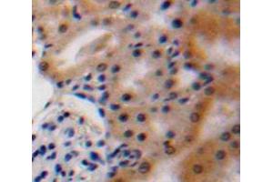 Used in DAB staining on fromalin fixed paraffin-embedded Kidney tissue (VEGFA 抗体  (AA 27-146))