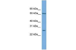 WB Suggested Anti-MED7  Antibody Titration: 0. (MED7 抗体  (Middle Region))