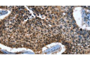Immunohistochemistry (Paraffin-embedded Sections) (IHC (p)) image for anti-Calcium Channel, Voltage-Dependent, beta 2 Subunit (CACNB2) antibody (ABIN7243076)