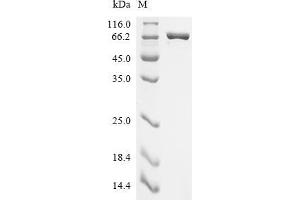 Alveolar Soft Part Sarcoma Chromosome Region, Candidate 1 (ASPSCR1) (AA 1-590), (full length) protein (His tag)