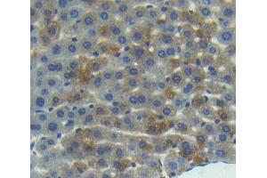 Used in DAB staining on fromalin fixed paraffin- embedded liver tissue (RGS10 抗体  (AA 16-181))