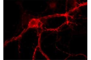 Immunocytochemistry on cultured hippocampus neurons (dilution 1 : 1000). (RAB3A 抗体  (AA 154-227))