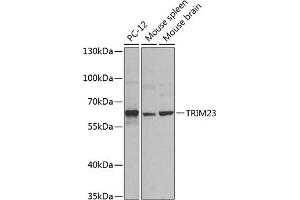 Western blot analysis of extracts of various cell lines, using TRIM23 antibody (ABIN6131175, ABIN6149508, ABIN6149509 and ABIN6224352) at 1:1000 dilution. (TRIM23 抗体  (AA 1-280))