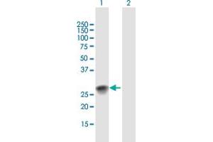Western Blot analysis of SSX2 expression in transfected 293T cell line by SSX2 MaxPab polyclonal antibody. (SSX2 抗体  (AA 1-188))