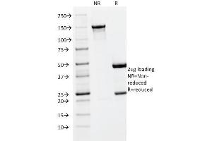 SDS-PAGE Analysis Purified PLGF Monoclonal Antibody (PLGF/93). (PLGF 抗体)