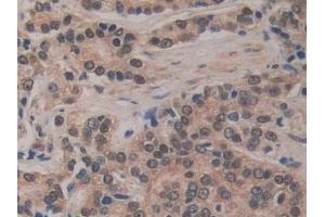Immunohistochemistry (IHC) image for anti-Breast Carcinoma Amplified Sequence 3 (BCAS3) (AA 230-546) antibody (ABIN7443374)