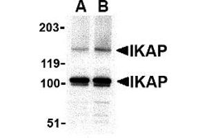 Western Blotting (WB) image for anti-Elongator Complex Protein 1 (ELP1) (C-Term) antibody (ABIN1030431) (IKAP/p150 抗体  (C-Term))