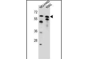 PLAG1 Antibody (N-term) (ABIN655594 and ABIN2845080) western blot analysis in NCI-,K562 cell line lysates (35 μg/lane). (PLAG1 抗体  (N-Term))