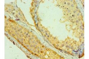 Immunohistochemistry of paraffin-embedded human testis tissue using ABIN7159251 at dilution of 1:100 (MAGEA1 抗体  (AA 1-309))