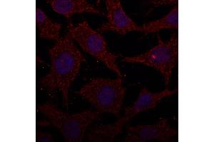 Immunofluorescence - anti-CTSD Ab at 1/100 dilution in NHI/3T3 cells, cells were fixed with methanol and permeabilized With 0. (Cathepsin D 抗体  (C-Term))