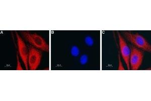 Expression of Aquaporin 4 in rat glioma C6 cells - Immunocytochemical staining of fixed and permeabilized rat glioma C6 cells. (Aquaporin 4 抗体  (C-Term, Intracellular))