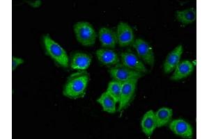 Immunofluorescent analysis of A549 cells using ABIN7142174 at dilution of 1:100 and Alexa Fluor 488-congugated AffiniPure Goat Anti-Rabbit IgG(H+L) (OAS3 抗体  (AA 424-565))