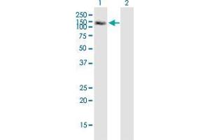 Western Blotting (WB) image for anti-Mitogen-Activated Protein Kinase Kinase Kinase 13 (MAP3K13) (AA 711-810) antibody (ABIN522632)
