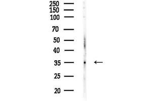 Western blot analysis of lysates from COLO205 cells, using DTNBP1 Antibody at 1/1000 dilution.