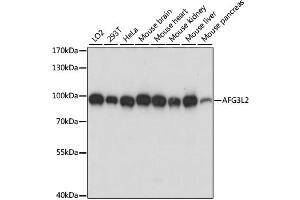 Western blot analysis of extracts of various cell lines, using AFG3L2 antibody (ABIN6292744) at 1:1000 dilution. (AFG3L2 抗体)