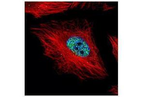 Immunofluorescence (IF) image for anti-Cyclin E1 (CCNE1) (C-Term) antibody (ABIN2855545)