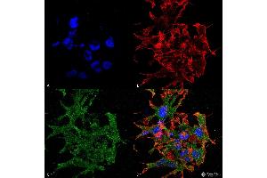 Immunocytochemistry/Immunofluorescence analysis using Mouse Anti-GABA-B Receptor 1 Monoclonal Antibody, Clone S93A-49 . (GABBR1 抗体  (AA 873-977) (FITC))