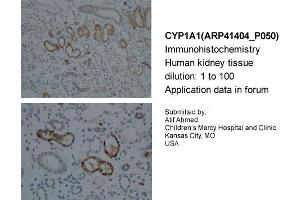 Sample Type: Human KidneyDilution: 1:100 (CYP1A1 抗体  (Middle Region))