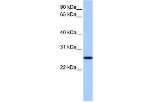 FBXO36 antibody used at 1 ug/ml to detect target protein. (FBXO36 抗体  (N-Term))