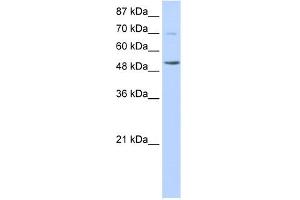 WB Suggested Anti-IKZF3 Antibody Titration:  0. (IKZF3 抗体  (N-Term))