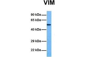 Western Blotting (WB) image for anti-Vimentin (VIM) (C-Term) antibody (ABIN2783289)