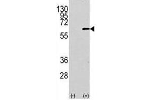 Western blot analysis of AKT1 antibody and 293 cell lysate (2 ug/lane) either nontransfected (Lane 1) or transiently transfected with the human gene (2). (AKT1 抗体  (AA 115-144))
