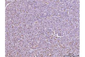 IHC analysis of HLA-DRA using anti-HLA-DRA antibody (ABIN7600949).
