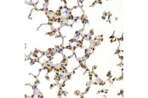 Immunohistochemistry of paraffin-embedded mouse lung using S100A4 antibody at dilution of 1:100 (x400 lens).