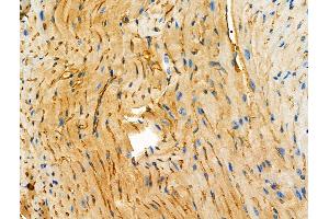 ABIN6264525 and ABIN6272534 at 1/100 staining Mouse heart tissue by IHC-P.