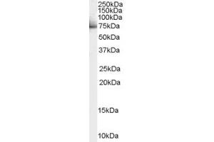 Image no. 3 for anti-Signal Transducer and Activator of Transcription 3 (Acute-Phase Response Factor) (STAT3) (Internal Region) antibody (ABIN185692)