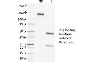 SDS-PAGE Analysis of Purified Clathrin HC Mouse Monoclonal Antibody (CLTC/1431). (Clathrin Heavy Chain (CLTC) (N-Term) 抗体)