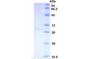 SDS-PAGE of Protein Standard from the Kit (Highly purified E. (CRP ELISA 试剂盒)