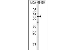 FSCN3 Antibody (C-term) (ABIN657009 and ABIN2846189) western blot analysis in MDA-M cell line lysates (35 μg/lane). (Fascin 3 抗体  (C-Term))
