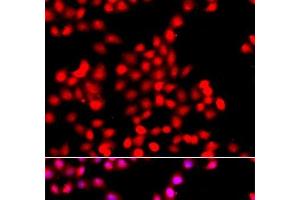 Immunofluorescence analysis of A549 cells using TTBK2 Polyclonal Antibody (TTBK2 抗体)