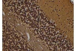 ABIN6269402 at 1/100 staining Rat brain tissue by IHC-P. (DARPP32 抗体)