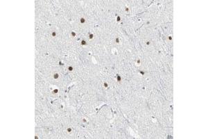 Immunohistochemical staining (Formalin-fixed paraffin-embedded sections) of human cerebral cortex with ZIC1 polyclonal antibody  shows strong nuclear positivity in neuronal and glial cells. (ZIC1 抗体)