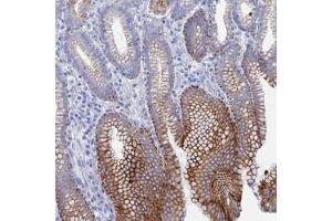 Immunohistochemical staining of human stomach, upper with DHX34 polyclonal antibody  shows strong cytoplasmic and membranous positivity in glandular cells.