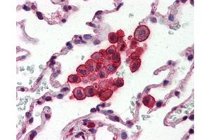 Anti-Clusterin antibody IHC of human lung. (Clusterin 抗体  (AA 1-333))