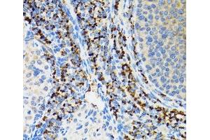 Immunohistochemistry of paraffin-embedded Rat ovary using SRP19 Polyclonal Antibody at dilution of 1:100 (40x lens). (SRP19 抗体)