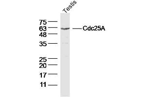 Mouse Testis lysates probed with Cdc25A Polyclonal Antibody, Unconjugated  at 1:300 dilution and 4˚C overnight incubation. (CDC25A 抗体  (AA 451-524))